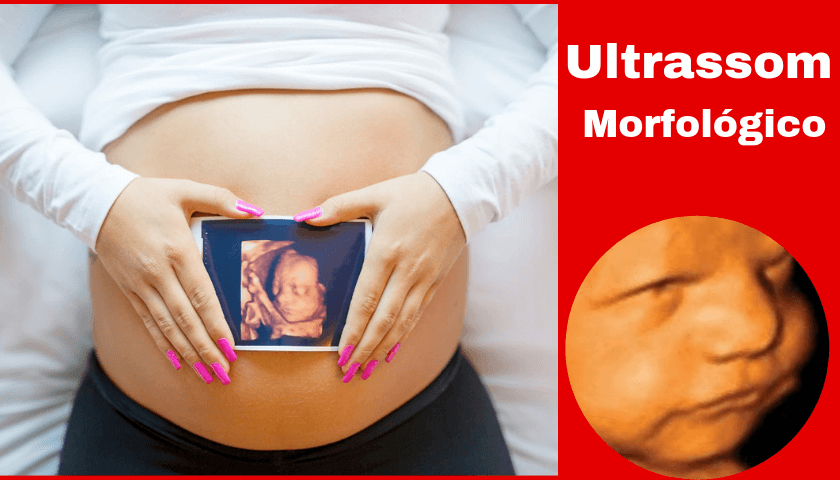 Ultrassom Morfológico Saiba Tudo Cantinho Infantil Da Mamãe 