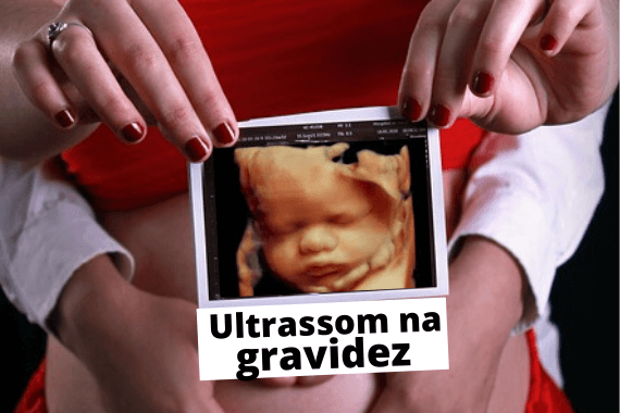 Ultrassom Gravidez Entenda Quais S O Os Tipos De Exames