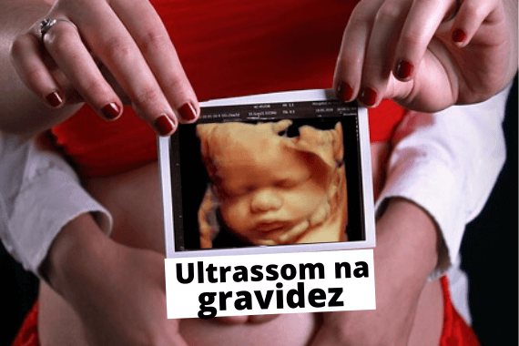Ultrassom Na Gravidez Saiba Tudo Cantinho Infantil Da Mamãe 